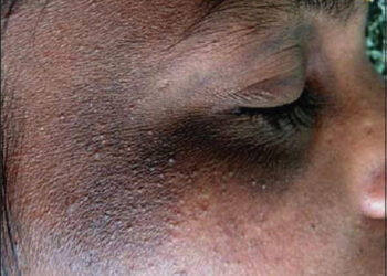 Here’s what happens when you bleach