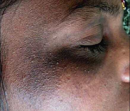 Here’s what happens when you bleach