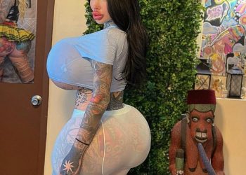 I regret doing plastic surgeries— Model 